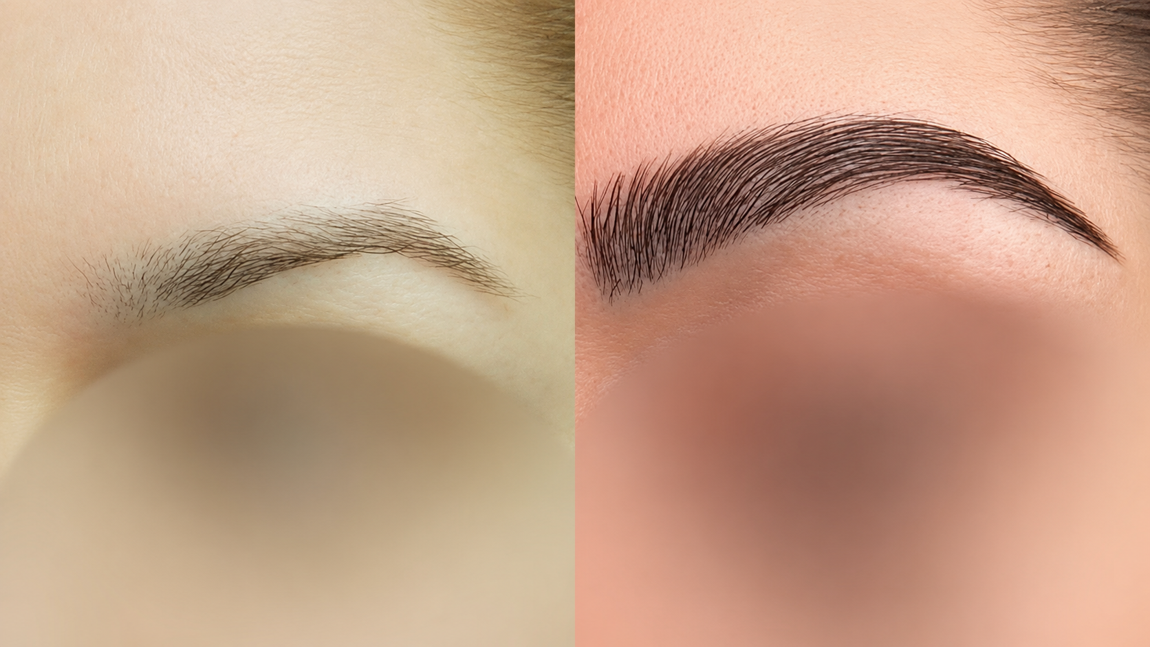 Hair transplant procedure close-up