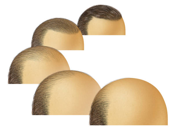 Natural hairline design close-up
