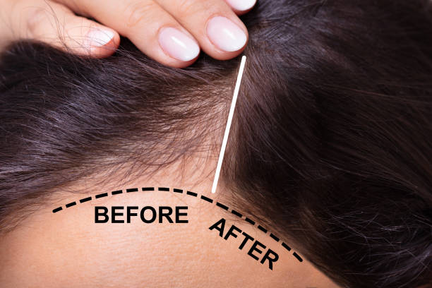 Hair regrowth result from combined medical therapy